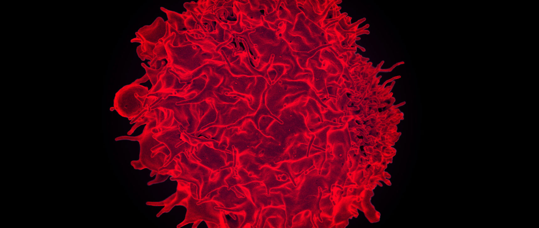 Colorized scanning electron micrograph of a T lymphocyte.